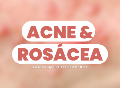 Leia mais sobre o artigo Acne e Rosácea: Gerenciamento Cosmético