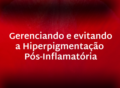 Leia mais sobre o artigo Gerenciando e evitando a Hiperpigmentação Pós-Inflamatória