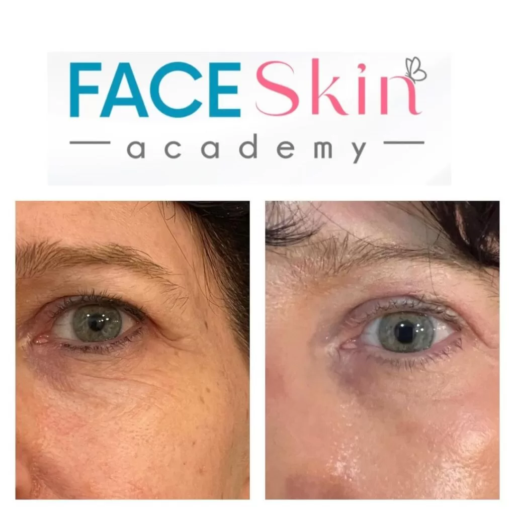 312832536_2049872408734416_4159842107692900096_n